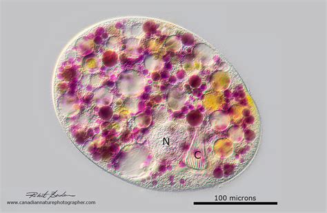  Nassula:  A Tiny Ciliate That Leaps Through Water Like a Miniature Acrobat!